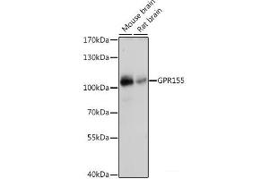 Western blot analysis of extracts of various cell lines using GPR155 Polyclonal Antibody at dilution of 1:1000. (GPR155 anticorps)