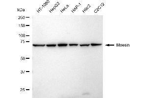 Western blotting analysis using Moesin antibody (ABIN7799482). (Recombinant Moesin anticorps)