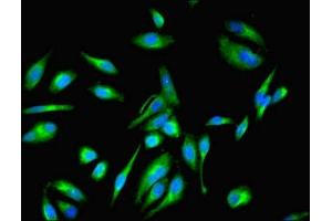 anti-Eukaryotic Translation Elongation Factor 1 epsilon 1 (EEF1E1) (AA 2-174) antibody