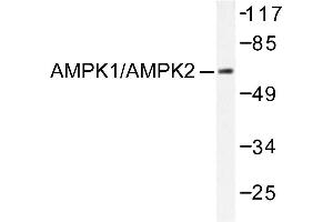 Image no. 1 for anti-Protein Kinase, AMP-Activated, alpha 1 Catalytic Subunit (PRKAA1) antibody (ABIN265306) (PRKAA1 anticorps)