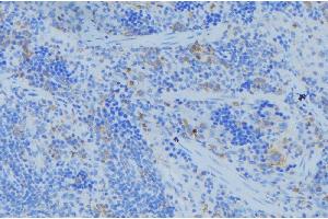 ABIN6273685 at 1/100 staining Human lymph node tissue by IHC-P. (Keratin 77 anticorps  (Internal Region))