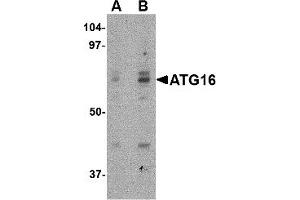 Western Blotting (WB) image for anti-ATG16 Autophagy Related 16-Like 1 (ATG16L1) (Middle Region) antibody (ABIN1030869) (ATG16L1 anticorps  (Middle Region))