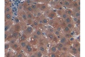 DAB staining on IHC-P; Samples: Human Liver Tissue (CTNNBIP1 anticorps  (AA 1-81))