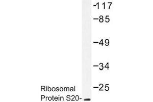 Image no. 1 for anti-Ribosomal Protein S20 (RPS20) antibody (ABIN317813)