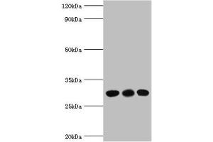 Western blot All lanes: CA1 antibody at 6 μg/mL Lane 1: Jurkat whole cell lysate Lane 2: K562 whole cell lysate Lane 3: Mouse spleen tissue Secondary Goat polyclonal to rabbit IgG at 1/10000 dilution Predicted band size: 29 kDa Observed band size: 29 kDa (CA1 anticorps  (AA 1-261))