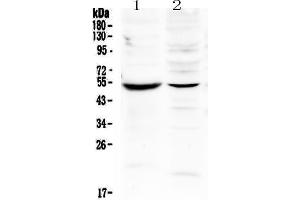 Western blot analysis of MMP16 using anti-MMP16 antibody .