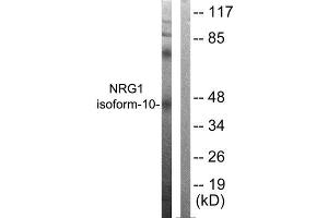 Western Blotting (WB) image for anti-Neuregulin 1 (NRG1) (Isoform 10), (N-Term) antibody (ABIN6299311) (Neuregulin 1 anticorps  (Isoform 10, N-Term))