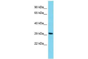 Host: Rabbit Target Name: C14orf105 Sample Type: HCT15 Whole Cell lysates Antibody Dilution: 1. (C14ORF105 anticorps  (C-Term))