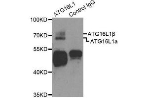 Immunoprecipitation (IP) image for anti-ATG16 Autophagy Related 16-Like 1 (ATG16L1) (AA 90-300) antibody (ABIN1678769) (ATG16L1 anticorps  (AA 90-300))