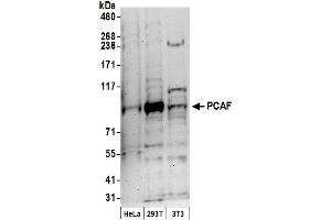 Western Blotting (WB) image for anti-K(lysine) Acetyltransferase 2B (KAT2B) (AA 782-832) antibody (ABIN7453310)