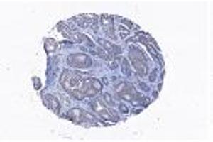 Image no. 1 for anti-Coronin, Actin Binding Protein, 1C (CORO1C) (AA 407-420) antibody (ABIN960848)