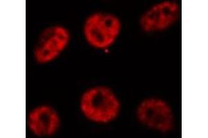 ABIN6269310 staining HeLa cells by IF/ICC. (RUNX1 anticorps  (Internal Region))
