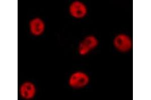 ABIN6277531 staining  RAW264. (GTF2A1 anticorps  (Internal Region))