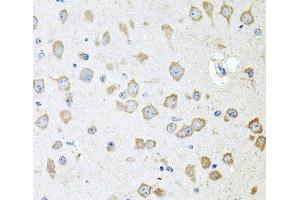Immunohistochemistry of paraffin-embedded Mouse brain using AKAP5 Polyclonal Antibody at dilution of 1:100 (40x lens).