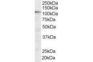 Western Blotting (WB) image for anti-Squamous Cell Carcinoma Antigen Recognized By T Cells (SART1) (N-Term) antibody (ABIN2466239) (SART1 anticorps  (N-Term))