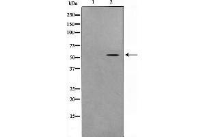 Western blot analysis on COLO205 cell lysate using STEA3 Antibody,The lane on the left is treated with the antigen-specific peptide. (STEAP3 anticorps  (N-Term))