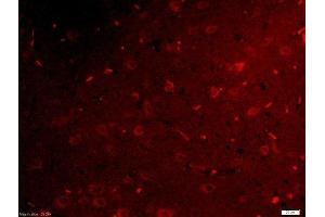 Formalin-fixed and paraffin embedded rat brain tissue labeled with Rabbit Anti-Netrin G1 Ligand Polyclonal Antibody, Unconjugated  used at 1:200 dilution for 40 minutes at 37°C.