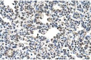 Immunohistochemical staining (Formalin-fixed paraffin-embedded sections) of human lung with CIZ1 polyclonal antibody  at 4-8 ug/mL working concentration. (CIZ1 anticorps  (C-Term))