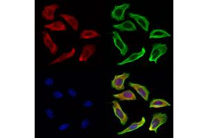 ABIN6263424 and ABIN6269252 staining Hela cells by IF/ICC.
