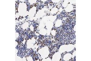 Immunohistochemical staining of human bone marrow with SPIN3 polyclonal antibody  shows strong nuclear and cytoplasmic positivity in bone marrow poietic cells. (SPIN3 anticorps)