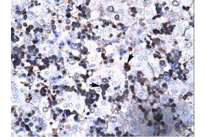 Image no. 1 for anti-Forkhead Box P3 (FOXP3) (AA 100-149) antibody (ABIN202505)
