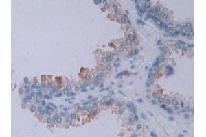 DAB staining on IHC-P; Samples: Human Prostate Tissue (NRP2 anticorps  (AA 231-490))