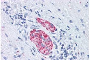 Human Nerve: Formalin-Fixed, Paraffin-Embedded (FFPE)