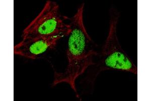 Fluorescent confocal image of SY5Y cells stained with (ABIN655156 and ABIN2844774) LIN28A (Center) antibody.