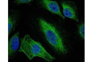 Immunofluorescence analysis of Hela cells using AURKA mouse mAb (green).
