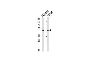 Western blot analysis of lysates from human brain tissue lysate and Jurkat cell line (from left to right), using CHN1 Antibody (N-term) (ABIN1881198 and ABIN2839098). (CHN1 anticorps  (N-Term))