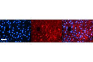 Rabbit Anti-RARA Antibody    Formalin Fixed Paraffin Embedded Tissue: Human Adult liver  Observed Staining: Cytoplasmic (abundant), Nuclear (very rare) Primary Antibody Concentration: 1:100 Secondary Antibody: Donkey anti-Rabbit-Cy2/3 Secondary Antibody Concentration: 1:200 Magnification: 20X Exposure Time: 0. (Retinoic Acid Receptor alpha anticorps  (Middle Region))