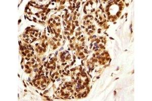 Immunohistochemical analysis of paraffin-embedded human breast using PIN1 antibody at 1:25 dilution.