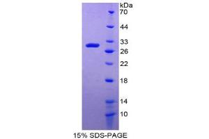 SDS-PAGE (SDS) image for Damage-Specific DNA Binding Protein 2, 48kDa (DDB2) (AA 166-383) protein (His tag) (ABIN1980714)
