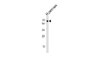 Western blot analysis of lysate from human pancreas tissue lysate, using ACVR2B Antibody (S14) A.