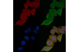 ABIN7095543 and ABIN7099600 staining Hela cells(45 min of heat-shock treatment) by IF/ICC. (RARS anticorps)