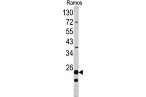 Western Blotting (WB) image for anti-Ribosomal Protein S9 (RPS9) antibody (ABIN3002715) (RPS9 anticorps)