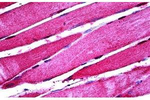 Human Skeletal Muscle: Formalin-Fixed, Paraffin-Embedded (FFPE) (ENO3 anticorps  (AA 228-278))