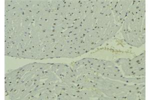 ABIN6277797 at 1/100 staining Mouse muscle tissue by IHC-P. (USP22 anticorps  (Internal Region))