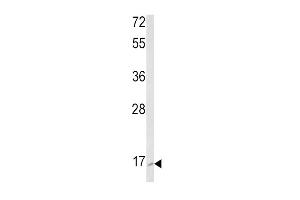 Western blot analysis of RAC2 Antibody (C-term) (ABIN652785 and ABIN2842514) in K562 cell line lysates (35 μg/lane).