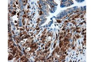 Immunohistochemical staining of paraffin-embedded Kidney tissue using anti-RC219453 mouse monoclonal antibody. (NPR3 anticorps)