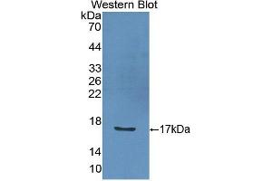 Figure. (IL-2 anticorps  (AA 21-155))