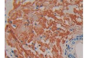 DAB staining on IHC-P; Samples: Human Prostate Tissue (IFNA7 anticorps  (AA 24-189))