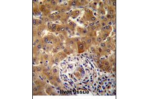 PHF17 Antibody (N-term) (ABIN657355 and ABIN2846405) immunohistochemistry analysis in formalin fixed and paraffin embedded human liver tissue followed by peroxidase conjugation of the secondary antibody and DAB staining. (PHF17 anticorps  (N-Term))
