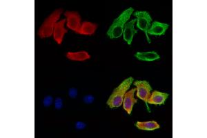ABIN7094889 and ABIN7098942 staining Hela cells by IF/ICC.