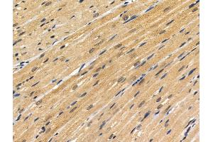 ABIN6256860 and ABIN6274329 at 1/100 staining Rat heart tissue by IHC-P. (FOXC1 anticorps  (Internal Region))