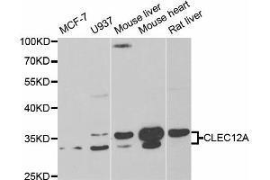 Western blot analysis of extracts of various cell lines, using CLEC12A antibody.