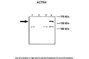 Lanes:   Lane1: 10 ug ACTN1-GFP transfected COS-7 lysate Lane2: 10 ug ACTN2-GFP transfected COS-7 lysate Lane3: 10 ug ACTN3-GFP transfected COS-7 lysate Lane4: 10 ug ACTN4-GFP transfected COS-7 lysate  Primary Antibody Dilution:   1: 1000  Secondary Antibody:   Anti-rabbit HRP  Secondary Antibody Dilution:   1:5000  Gene Name:   ACTN4  Submitted by:   Johannes W.