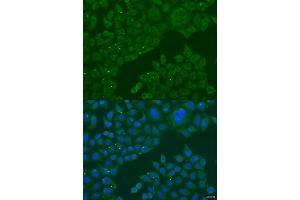 Immunofluorescence analysis of U2OS cells using B3GALNT1 antibody (ABIN2736338) at dilution of 1:100. (B3GALNT1 anticorps)