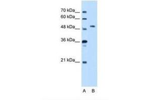 Image no. 1 for anti-serine threonine Kinase 39 (STK39) (AA 151-200) antibody (ABIN321508) (STK39 anticorps  (AA 151-200))