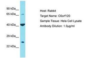 Image no. 1 for anti-Chromosome 6 Open Reading Frame 120 (C6ORF120) (C-Term) antibody (ABIN6750803)